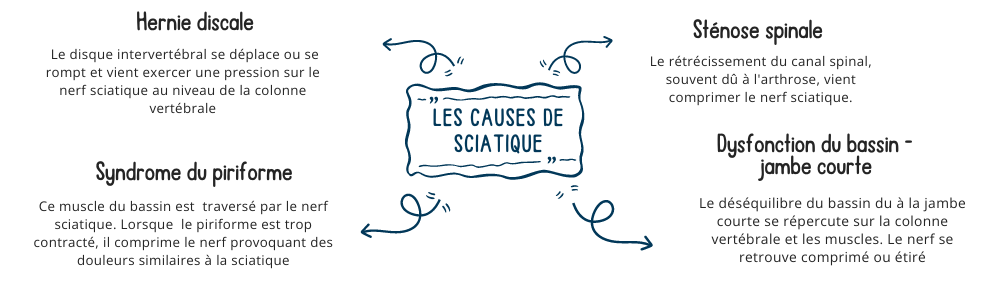 Les causes des douleurs de sciatiques