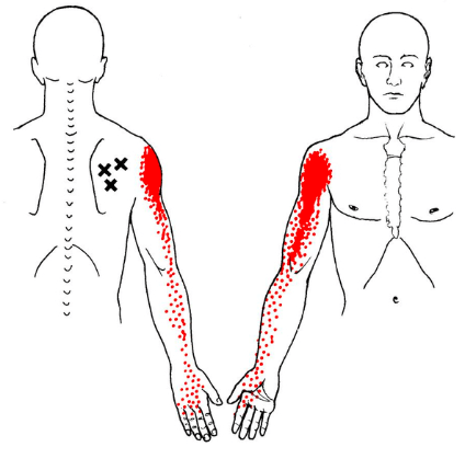 Chiropraxie douleurs musculaires dos epaule dorsale